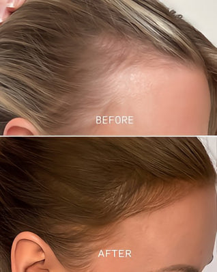 Precision Trace®